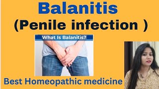 Balanitis  Penis infection treatment  Balanitis symptoms causes amp Homeopathic medicine hindi [upl. by Angadreme632]