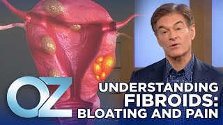 Are Your Fibroids Making You Bloated and Painful Heres What You Need to Know  Oz Health [upl. by Melanie]