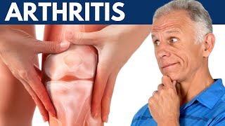 What I Wish Everyone Would Know About Arthritis [upl. by Mashe]