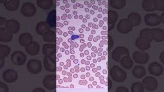 Reactive lymphocytes knowledge science [upl. by Jenna]