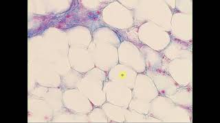 Loose c t  Adipose tisse Massons Trichrome Adipose tissue [upl. by Ammadis]