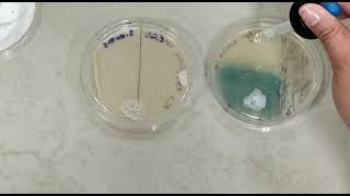 Prueba catalasa en Pseudomonas aeruginosa [upl. by Azaria762]