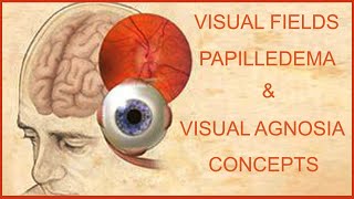 VISUAL FIELDS PAPILLEDEMA amp VISUAL AGNOSIA CONCEPTS [upl. by Ennovyhc]