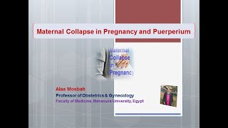 Maternal Collapse in Pregnancy and Puerperium [upl. by Haimorej521]