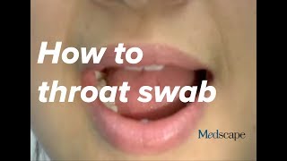 How to perform a throat swab on a patient [upl. by Weidar435]