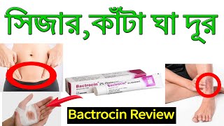 Bactrocin Ointment Cream Review  Easy Way To Get Rid of Thorns [upl. by Windy]