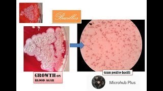 Bacillus bacillus colony on blood agar Gram stain Gram positive bacilli [upl. by Ellehcar539]