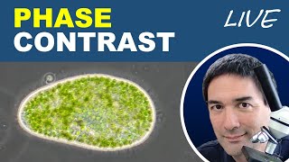 What is phase contrast microscopy [upl. by Ambler]