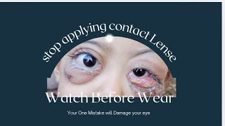 🔞Is It Safe To Wear Contact Lens🔞 Stop Doing These Mistakes 👁️❌contactlenses [upl. by Anafetse]