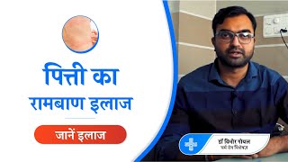 शीतपित्त पित्ती Urticaria का रामबाण इलाज  Urticaria causes symptoms amp treatment  AAYU APP [upl. by Eelanaj]