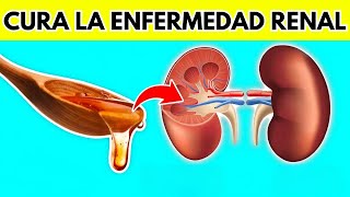 NINGÚN paciente renal volverá a perder un riñón Mira Esto [upl. by Drucilla]