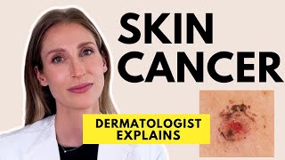 Skin Cancer Different Types Causes Prevention amp Treatments  Dr Sam Ellis [upl. by Powers]