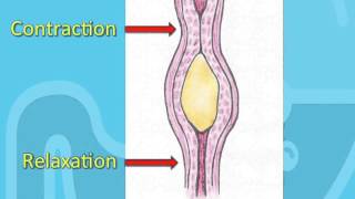 Swallowing Disorders and Achalasia [upl. by Assiren]