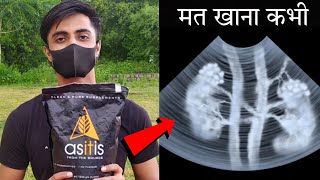 ASITIS Side Effects  हो गया खुलासा इस सस्ते ब्रांड का  Asitis Review protein gymlife [upl. by Ardnoek825]