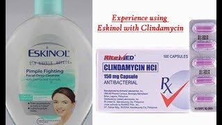 2019 Acne Story Part 1 EXPERIENCE Eskinol with dalacin cclindamycin [upl. by Tavey]