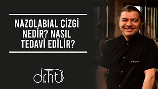 Nazolabial Çizgi Nedir Nasıl Tedavi Edilir [upl. by Brahear]