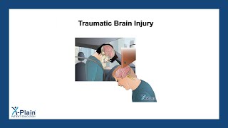 Traumatic Brain Injury [upl. by Henig544]