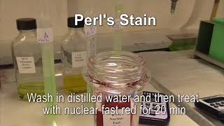 Perls stain for hemosiderin [upl. by Wivinia]