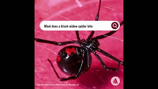 What Does A Black Widow Spider Bite Feel Like [upl. by Irehc]