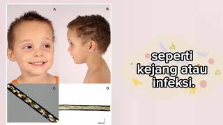 GM3 synthase deficiency Trichothiodystrophy Canavan disease Degenerasi makula terkait usia AMD [upl. by Korns876]