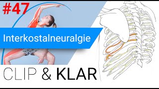 Interkostalneuralgie erklärt  ZwischenRippenNervenschmerz [upl. by Cesaria]