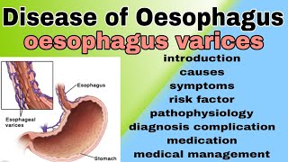 Disease of Oesophagus [upl. by Llenral]