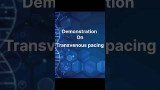 Transvenous pacing ✨✌️ [upl. by Akimik]