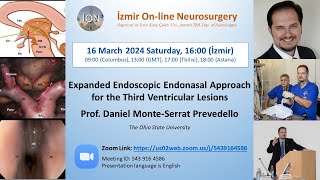 İON 429 Lecture Prevedello Expanded Endoscopic Endonasal Approach for the 3rd Ventricular Lesions [upl. by Ellitnahc]