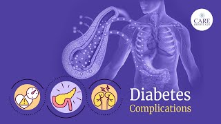 Serious Complications of Diabetes or Uncontrolled Blood Sugar [upl. by Jerri]