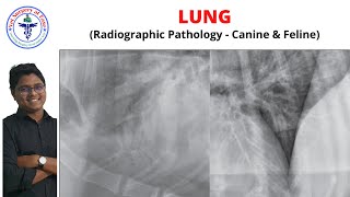 Lung  Radiology  Lecture 16 [upl. by Pillyhp]