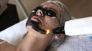 quotHollywood Carbon Laser Facials Gives You Glass Skin Tightens Smooths and Brightens [upl. by Hehre]