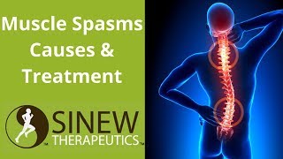 Muscle Spasms Causes and Treatment [upl. by Luella]