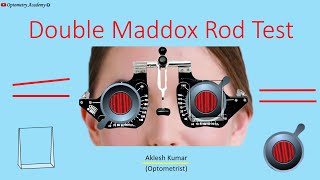 Double Maddox Rod Test [upl. by Earej735]