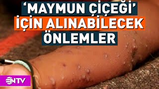 Maymun Çiçeği Hastalığının Belirtileri Neler  NTV [upl. by Steck]