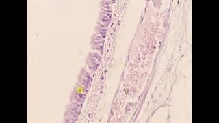 Pseudostratified columnar epithelium with cilia Trachea [upl. by Lednam]