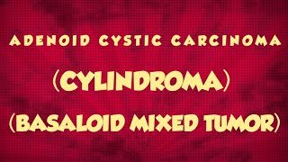 SALIVARY GLAND TUMORS  ADENOID CYSTIC CARCINOMA  CYLINDROMA [upl. by Johnathan]