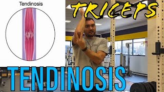 Triceps Tendinosis Exercise and Pathophysiology [upl. by Rawley]