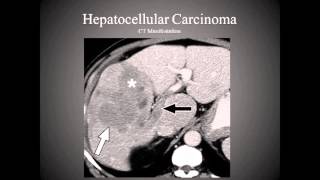 The Hepatobiliary System [upl. by Samled]