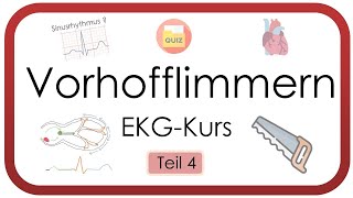 Vorhofflimmern sicher erkennen – EKG auswerten leicht gemacht Tachyarrhythmia absoluta EKGKurs [upl. by Enitsirk]