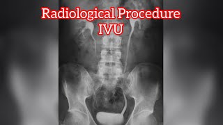 IVU  IVP Procedure  Radiology Procedure  Radiographer  Rso [upl. by Jairia]