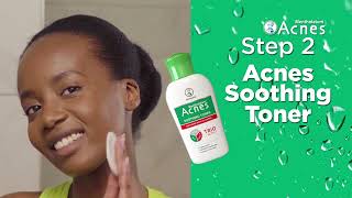 Clear Pimples in 3 easy steps [upl. by Fawcette]