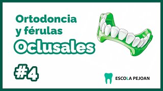 Módulo 4  Ortodoncia y Férulas Oclusales  Grado Superior Prótesis Dentales [upl. by Martguerita543]