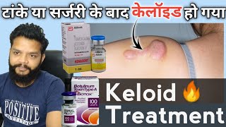 Keloid क्या होता है कारण ओर इलाज  Remove Keloid amp Hypertrophic Scar [upl. by Devora]