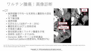 Parotid gland tumor Warthin tumor answer [upl. by Norabal]