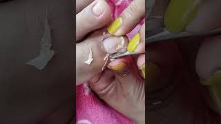 cleaning toenail full of dry skin pedicure videos subscribe satisfying [upl. by Starinsky]