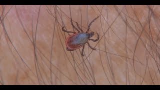 Blacklegged Ticks The Importance of Precaution [upl. by Annoyi124]