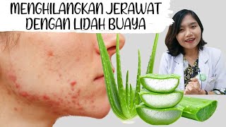 DIY Aloe Vera untuk Jerawat  Cara Pakai Lidah Buaya dirumah  dr Emasuperr [upl. by Leiuqese]