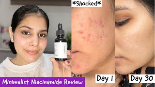 How I Cleared My Acne Within 30 Days  Minimalist 10 Niacinamide  Zinc Review [upl. by Giustina]