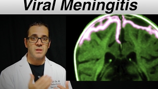 viral meningitis  Patient Education Video [upl. by Modnar]