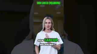 Skin Cancer Melanoma  Early Detection of Skin Cancer Signs amp Prevention Tips skincancer viral [upl. by Dewees]